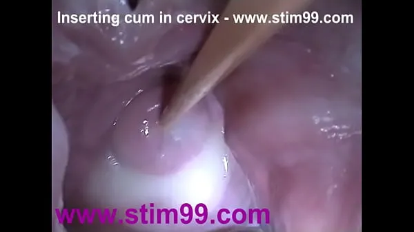 Nuovi Inserimento dello sperma in cervice Ampio speculum della figa che si estende clip Clip