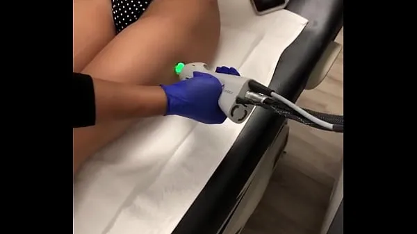 Nuovi Recording laser hair removal clip Clip